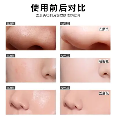Bamboo Charcoal Blackhead Removal Nose Strips, Peel-Off - 5