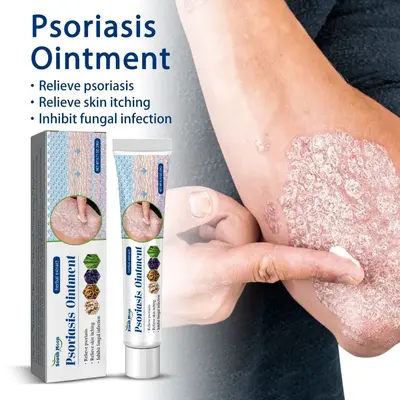 Anti-Itch Skin Cream for Men and Women, Dry Skin and Rash Care
