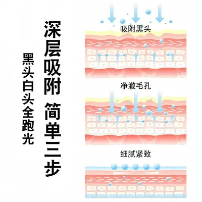 小猪去黑头鼻贴收缩毛孔清透清洁去闭口粉刺黑头导出液男女草莓鼻