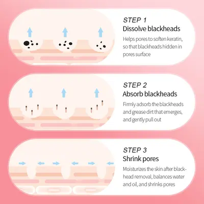 SADOER Blackhead Removal Three-Step Set, Nose Strips, Cleanses and Refines Pores