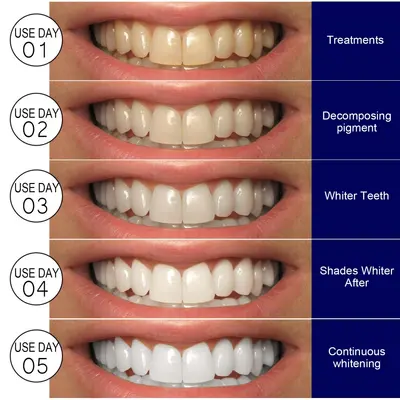 EELHOE Whitening Teeth Strips, Gentle Formula, Daily Care - 3