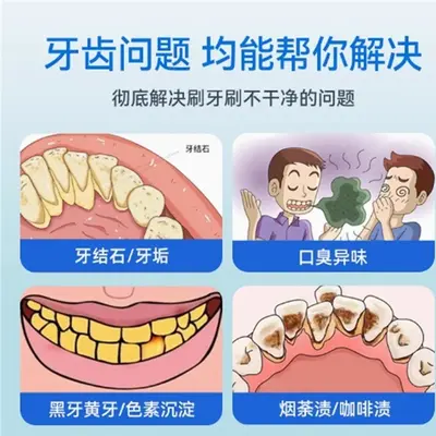 Ultrasonic Teeth Cleaner Portable Water Dental Flosser - 3