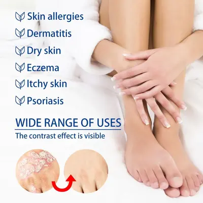 Anti-Itch Skin Cream for Men and Women, Dry Skin and Rash Care