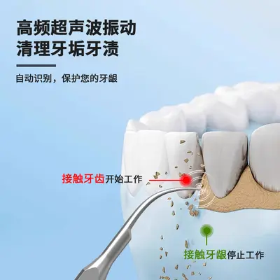 Ultrasonic tooth cleaner, home use, stain remover