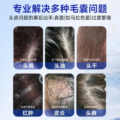 Selenium Disulfide Shampoo, Anti-Dandruff and Anti-Itch - 5