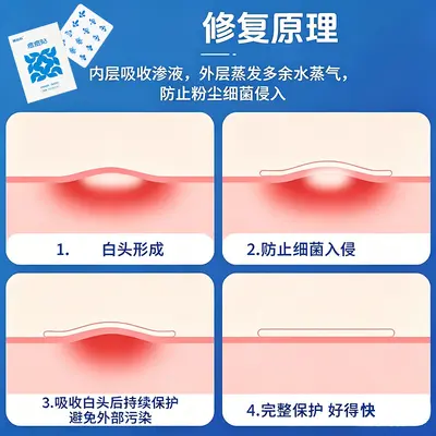 Hydrocolloid Sterile Acne Patch 10mm 12mm, Waterproof, Overnight Use - 4