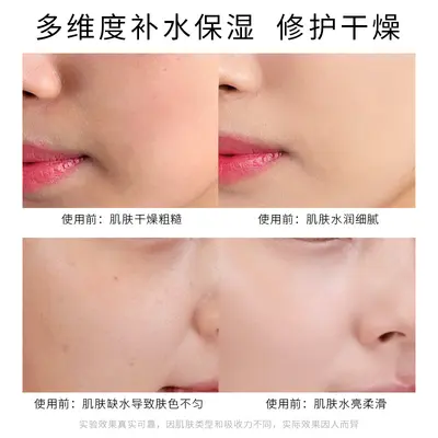 Büyük Hacimli Nemlendirici Hyaluronik Asit Serum, Güzellik Salonu İçin