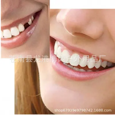 Temporary Instant Smile Veneers Realistic Whitening Teeth Covers - 5