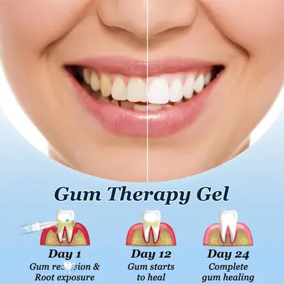Teeth whitening pen, tea stain remover, care gel - 5