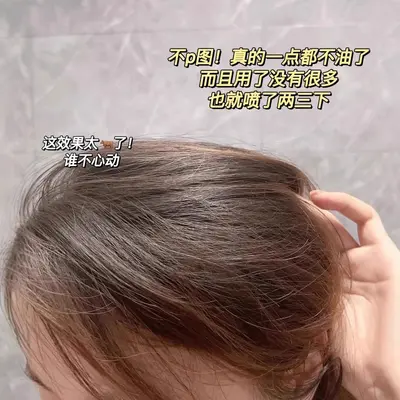 Spes Shi Pei Si Dry Hair Spray Spes Shipeisi Dry Shampoo Spray Oil Control Hair Magic for Removing Greasy Hair, Dry and Fluffy Volume Powder - 4
