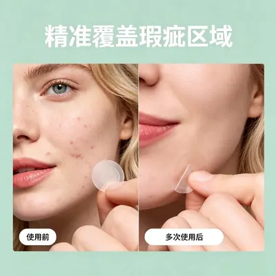 可溶性玻尿酸微针痘痘贴 水胶体物理吸收 隐形痘痘贴盒装9粒微针 - 4