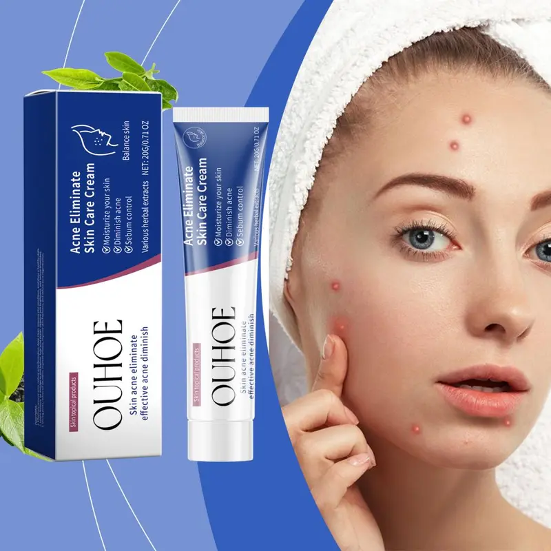 OUHOE Herbal Acne Cream, Gentle Moisturizing Facial Care