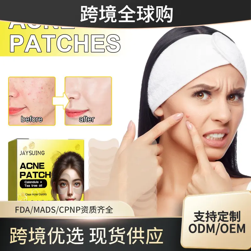 Jaysuing 痘痘贴片 清洁面部痘痘粉刺闭口去黑头细腻肌肤痘痘贴片