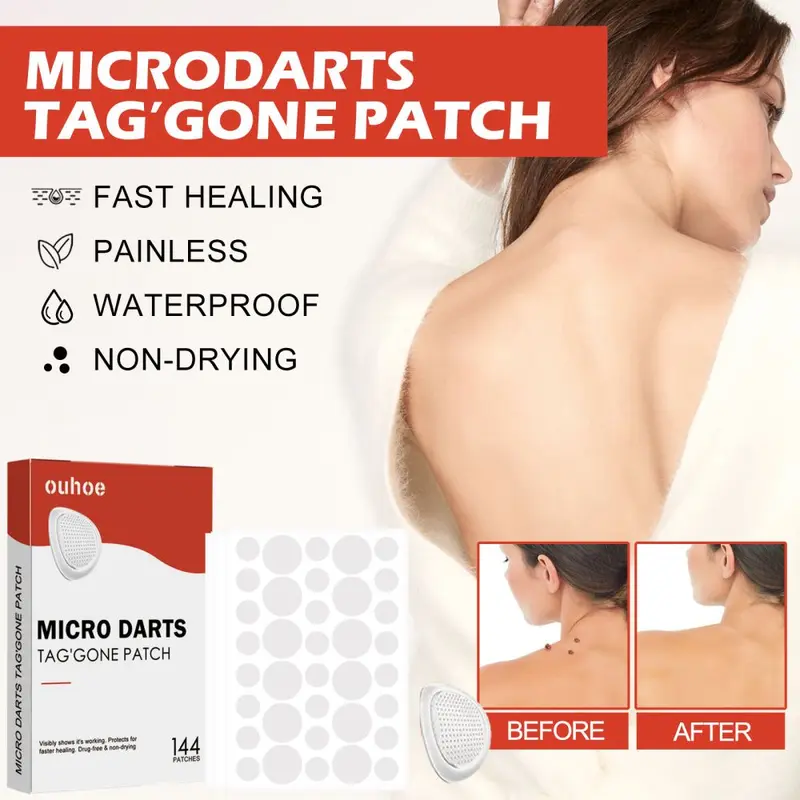 OUHOE Acne Patch for Blackheads, Skin Tags, Warts and Corn Spots